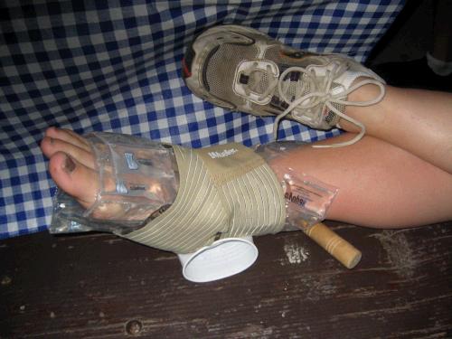 Once we got some Advil in her and an ice blanket around her foot she claimed to be a "happy camper."